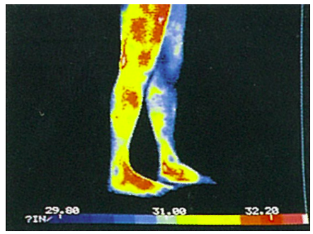 沼津市 ダイエット