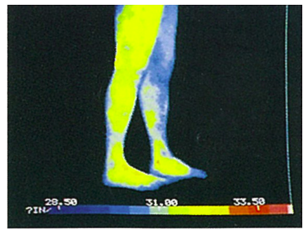 沼津市 ダイエット